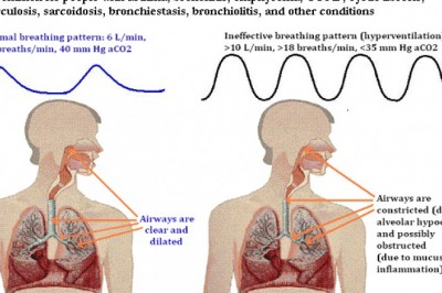 Bronchospasm natural treat