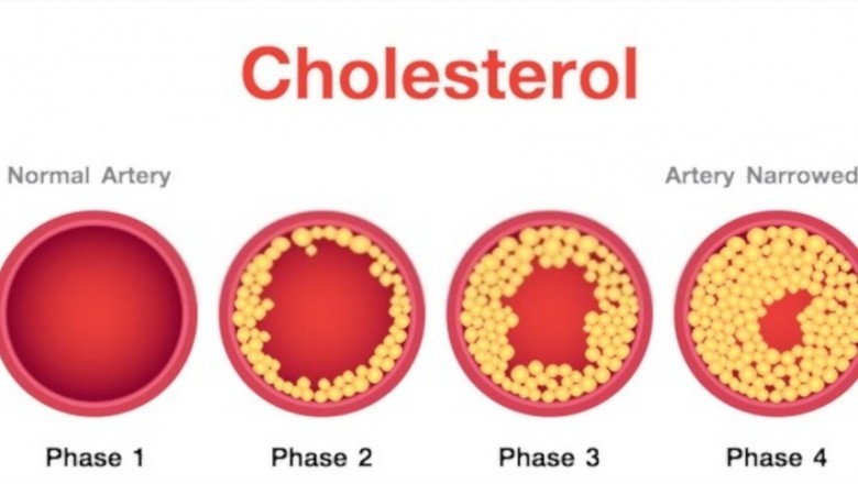 Herbal Cure For Cholesterol - Herbs To Lower Cholesterol