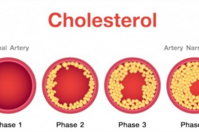 Herbal Cure For Cholesterol - Herbs To Lower Cholesterol