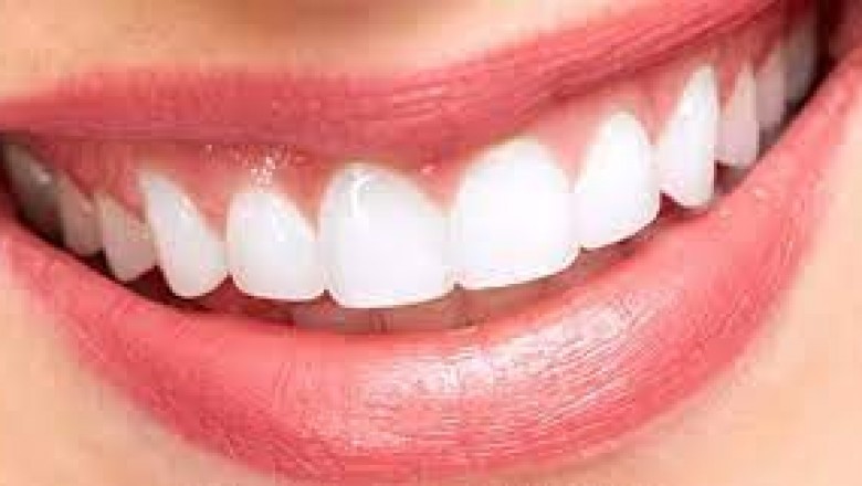 Veneers Treatment Near Me