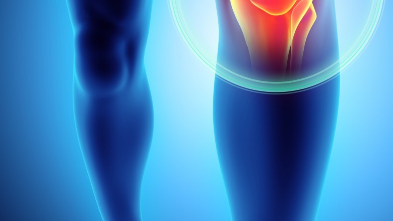 What To Expect After Knee Replacement Surgery?