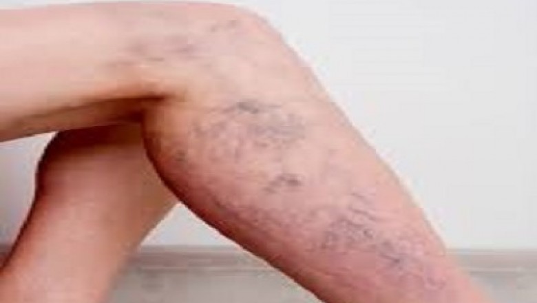 Advantages of Dental Implant For Oral health