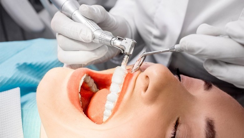 Professional Dental Care is very important to ensure that the teeth are healthy and strong, as good oral/dental health translates into overall good health.