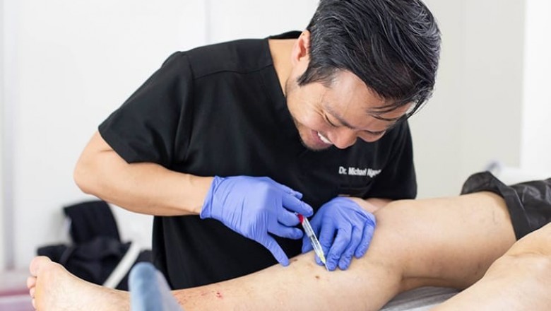 What are the Alternatives to Vein Stripping Procedure for Varicose Vein Treatment?