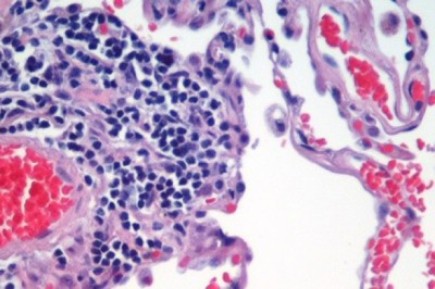 Histology & Cytology Market Global Industry Analysis, Size, Share, Growth, Trends, and Forecast, 2020-2030