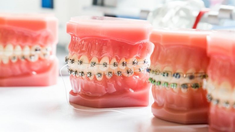 Tooth Extraction: What Are The Risks And Complications?