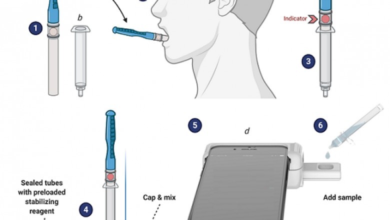 Cancer Spit Test Device Market 2021: Estimate CAGR Analysis, Technological Development Overview, Growth Trends and Competitive Analysis Till 2028