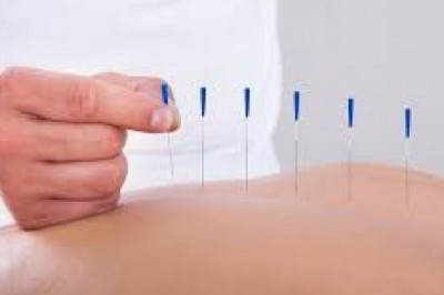 How Acupuncture Can Help With Infertilty