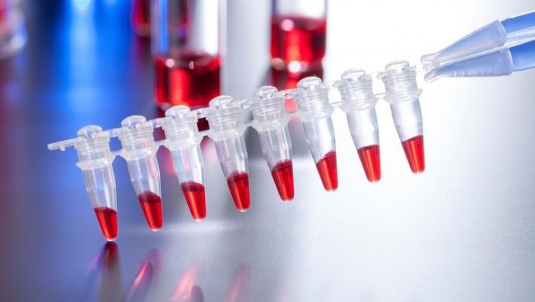 Fibrinogen concentrates have become an important aspect of new therapeutic options for paediatric and adult patients with acute bleeding episodes