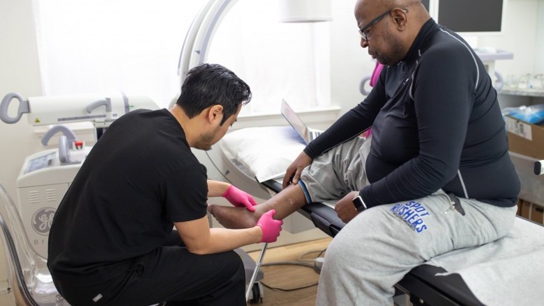 What are the Benefits of Varicose Vein Doctor and Varicose Vein Treatment?