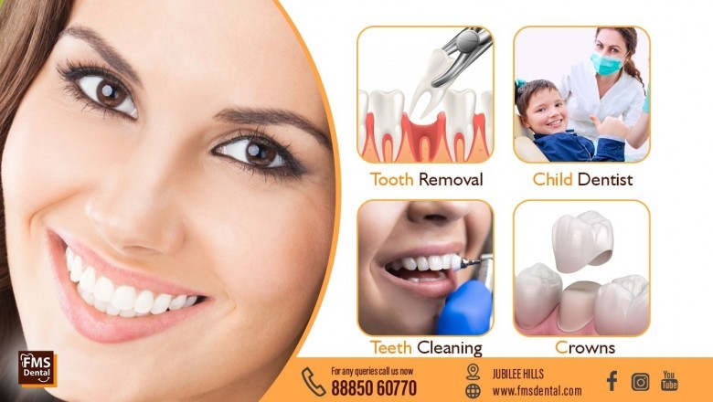 Best Dental Clinic in Hyderabad For Dental Implants is FMS Dental Hospital India Jubilee Hills