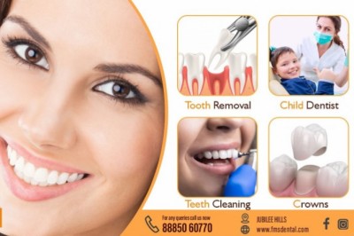 Best Dental Implant Clinic in Jubilee Hills