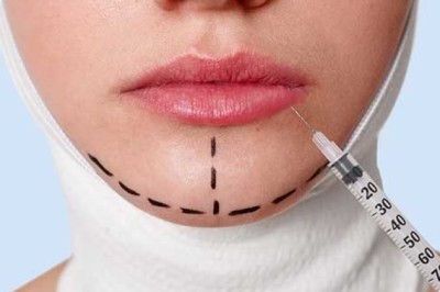 Thread Face Lift Cost In Bangalore