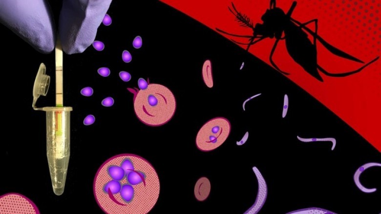 Global Malaria Diagnostics Treatment Market Detail Analysis focusing on Key Players | Forecasts 2021-2028