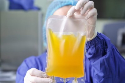 Global Plasma Therapy Treatment Market SWOT Analysis, Key Indicators and Forecast To 2028