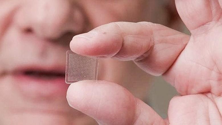 Global Microneedle Market Report 2020 - Market Size, Share, Price, Trend and Forecastv