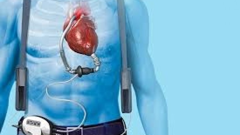 Growth in Sales of Cardiac Assist Devices Market to Push Revenue Growth in the Market