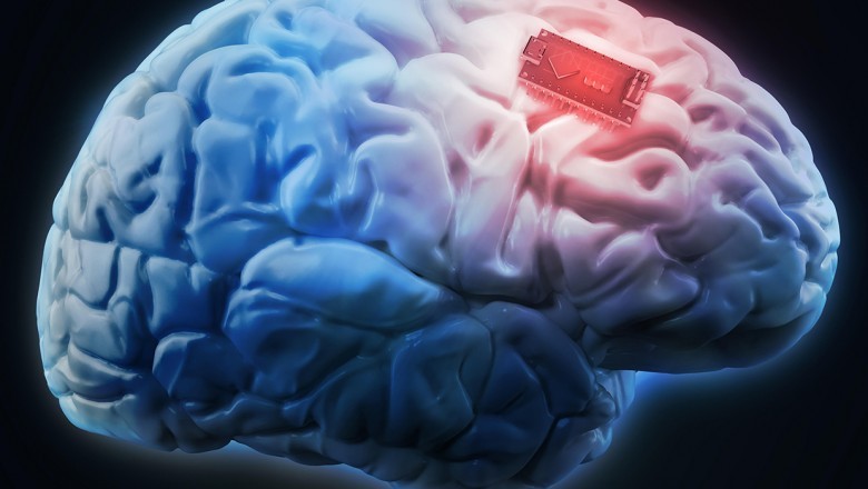 Brain Implants Market Report 2021-26: Outlook, Demand, Keyplayer Analysis