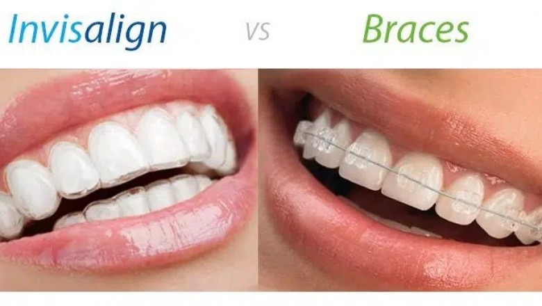 How Much Does Invisibility Cost?