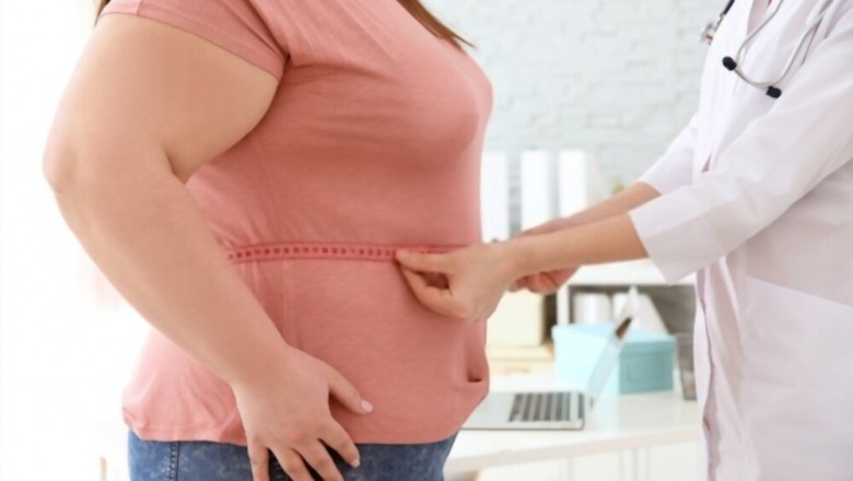 Causes of Obesity - Top 5 Causes of Obesity