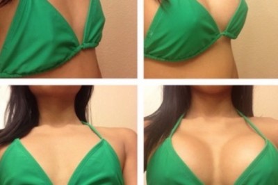 A Quick Overview of Breast Reduction