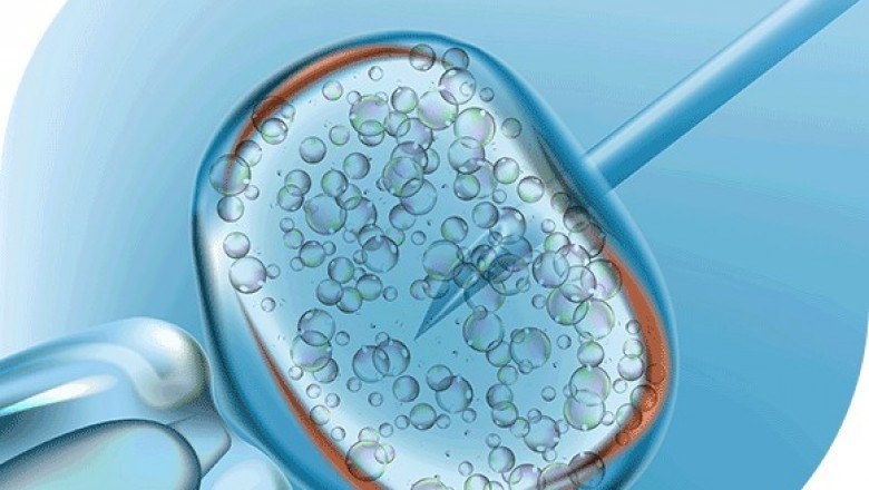 Best Infertility Hospital In Bangalore