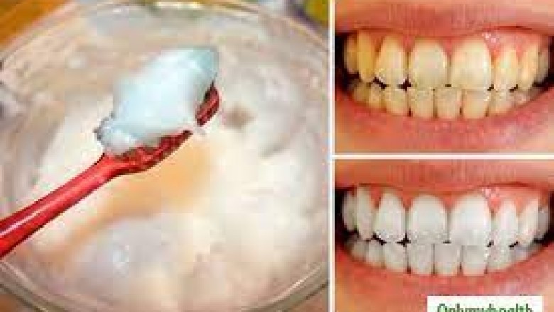 Cavity filling; the task, aftercare, and long-lasting