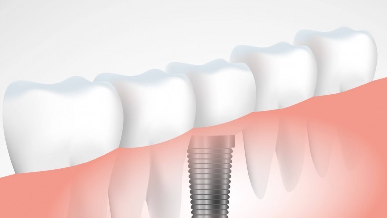 5 Things to Consider Before Getting Toothpaste