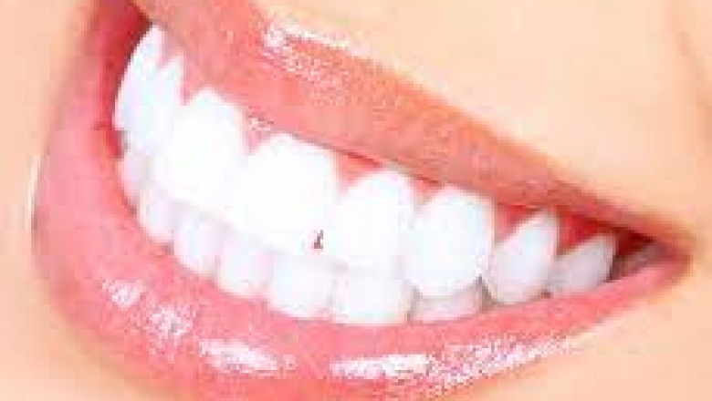 Porcelain Veneers: Get Perfect Shaped Smile.