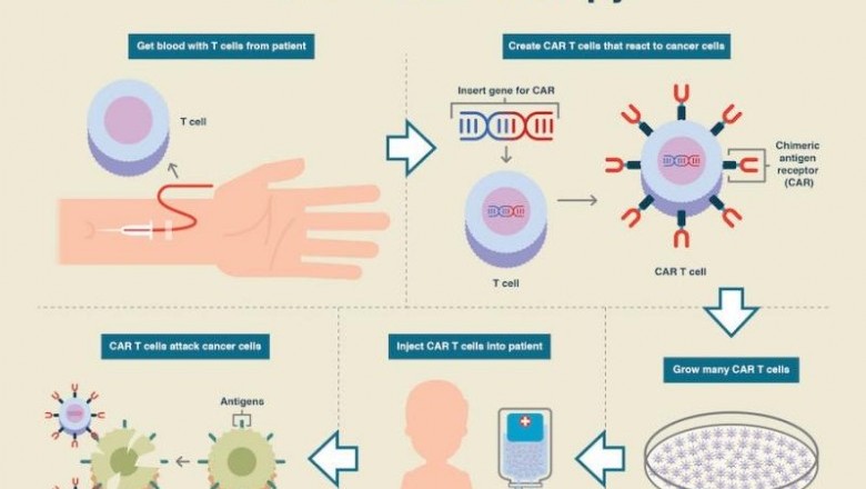 The Global CAR-T Cell Therapy Market is expected to be valued at US$ 7.7 Billion by 2028