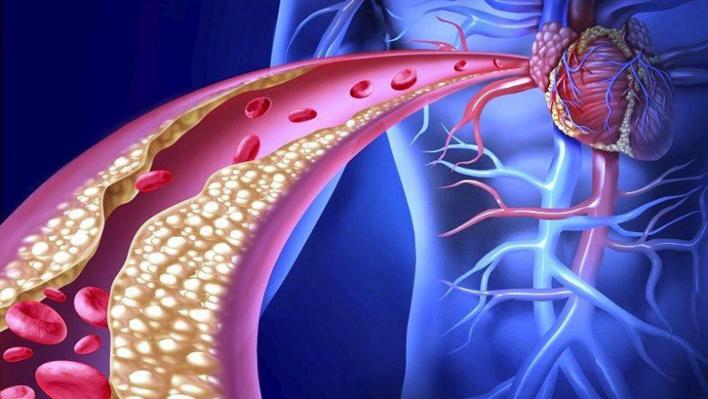 Familial Hypercholesterolemia Treatment Market – The Biggest Trends to Watch out for 2021-2030