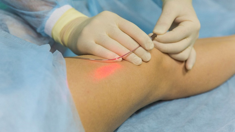 Vascular Injury Treatment Depends Mostly on the Location and Site of the Injury