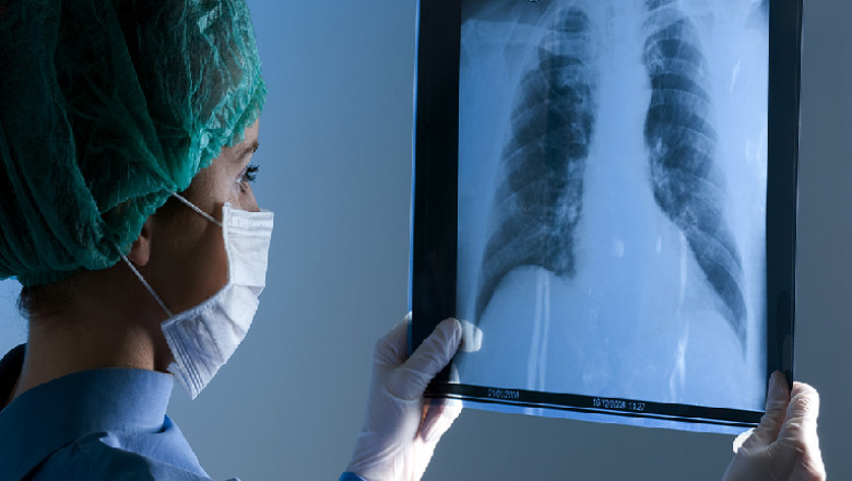 X-ray detectors have revolutionized the way cancer is diagnosed