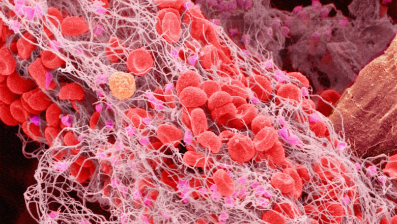 Europe Heparin Market 2021 : Size, Growth Opportunities, Current Trends, Forecast by 2028