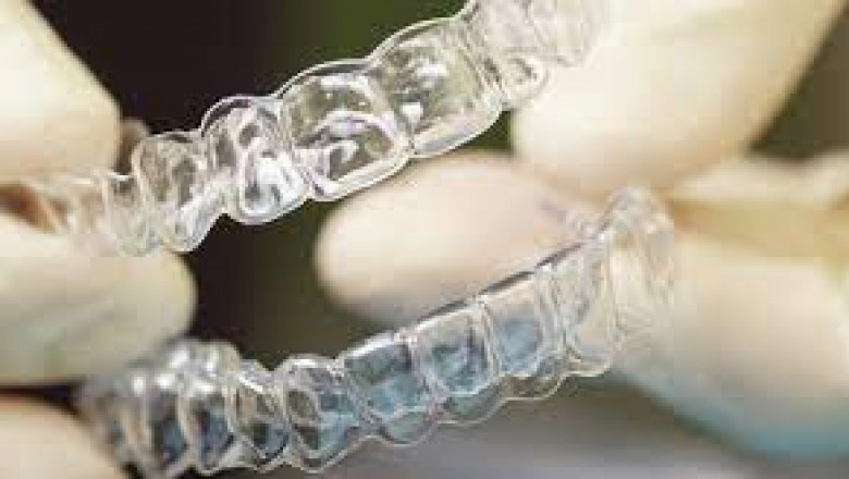 What are the Benefits and Costs of Cosmetic Dentistry?