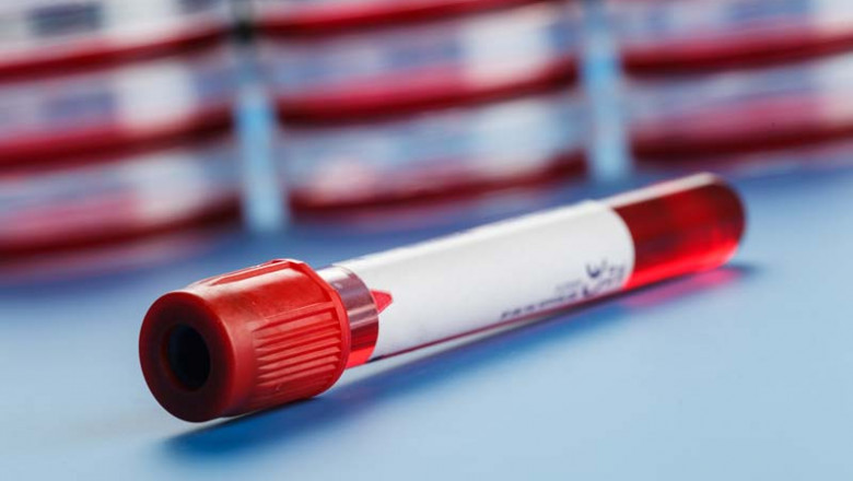 The purpose of the blood coagulation tubes is to collect blood samples for studying the amount of coagulation in the blood of the human body.