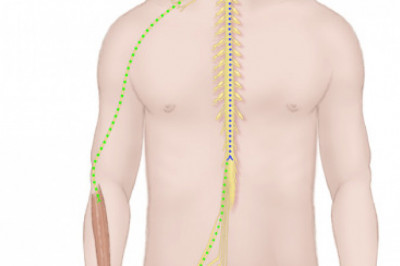 Amyotrophic Lateral Sclerosis Market Projected to Grow Radiantly by 2025; Asserts MRFR Unleashing the Forecast for 2019-2027