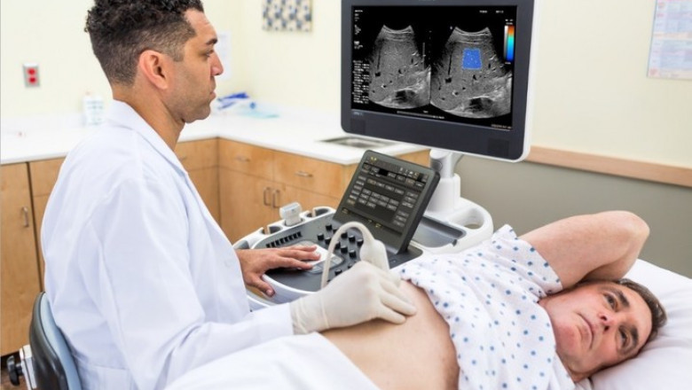 Elastography Imaging Market Segmentation and Analysis by Recent Trends and Growth Prospects by Regions to 2027