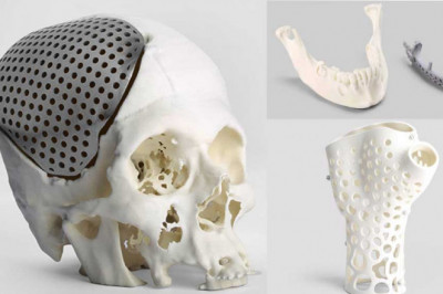 Global 3D Printing Medical Devices Market Size Research Report 2021 | Global Industry Sales, Revenue, Price Trends And More | Covid-19 Impact Analysis by MRFR