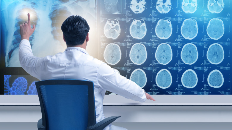 Medical Imaging Market Economic Trends, Industry Development, Challenges, Forecast and Strategies To 2027