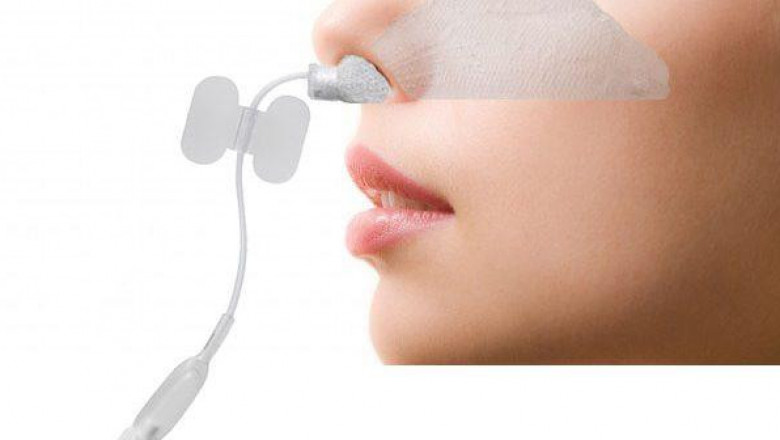 Absorbable Nasal Implant Devices Market – Growth, Latest Trend & Forecast 2026