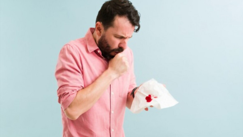 Coughing Up Blood Home Remedies - Home Remedies to Cure Coughing