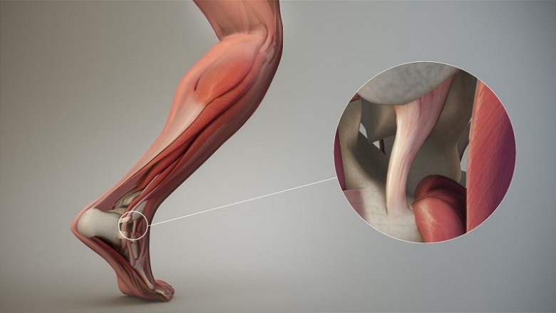 Soft Tissue Repair Market research by dbmr forecast to 2027
