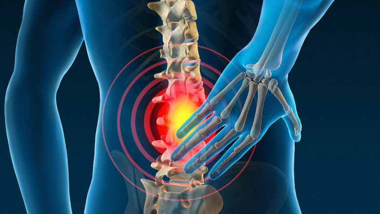 What are the best ways to treat back pain?