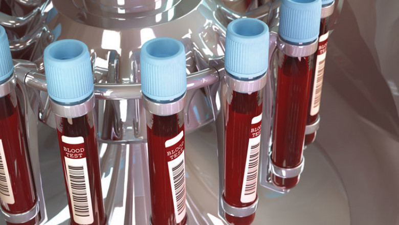 Blood Group Typing Market The Top Trends Impacting its Growth; MRFR Reveals Insights for 2019-2027
