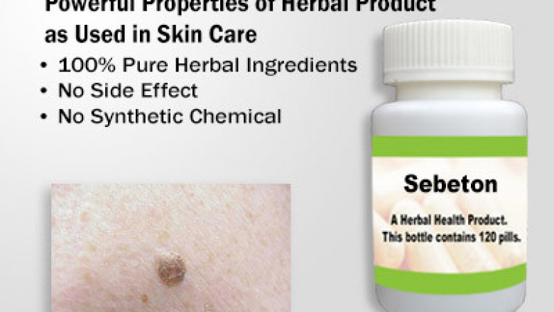 Effective Natural Remedies for Seborrheic Keratosis