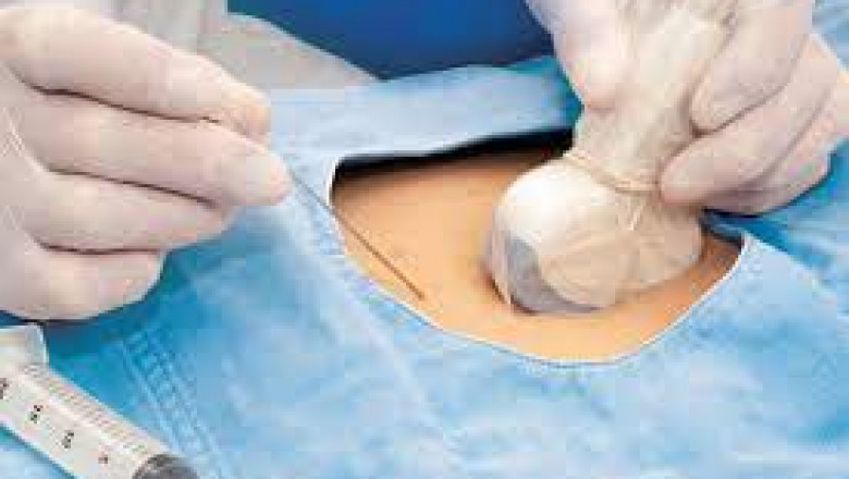 The global medical ultrasonic probe covers market is expected to exhibit a CAGR of 5.8% over the forecast period (2021-2028).