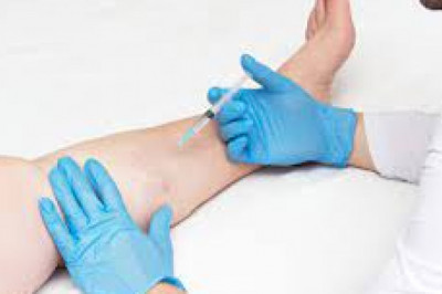 Does Vasculyse Treatment and Vitamin K Creams Works as a Spider Vein Treatment?