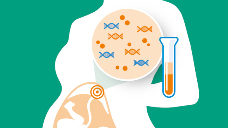 Non-Invasive Prenatal Testing (NIPT) Market Investment Opportunities, Upcoming Challenges, Growth Forecast, Current Trends 2027