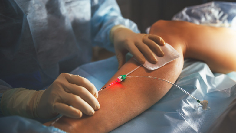 North Shore Vein Treatment Near Me
